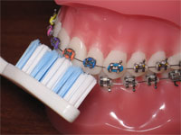 Dental Emergencies
