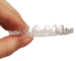 Invisalign
